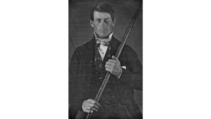A portrait of Phineas Gage